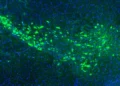 Laboratory research illustrating proteins linked to the spread of Parkinson’s disease in brain cells.