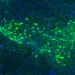 Laboratory research illustrating proteins linked to the spread of Parkinson’s disease in brain cells.