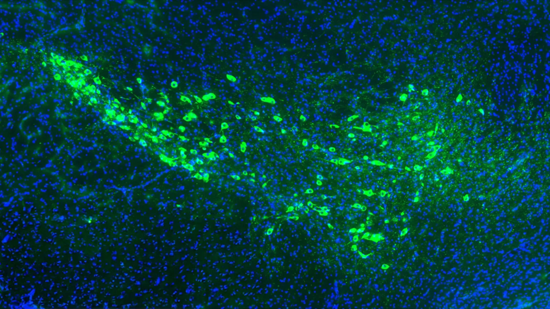 Laboratory research illustrating proteins linked to the spread of Parkinson’s disease in brain cells.